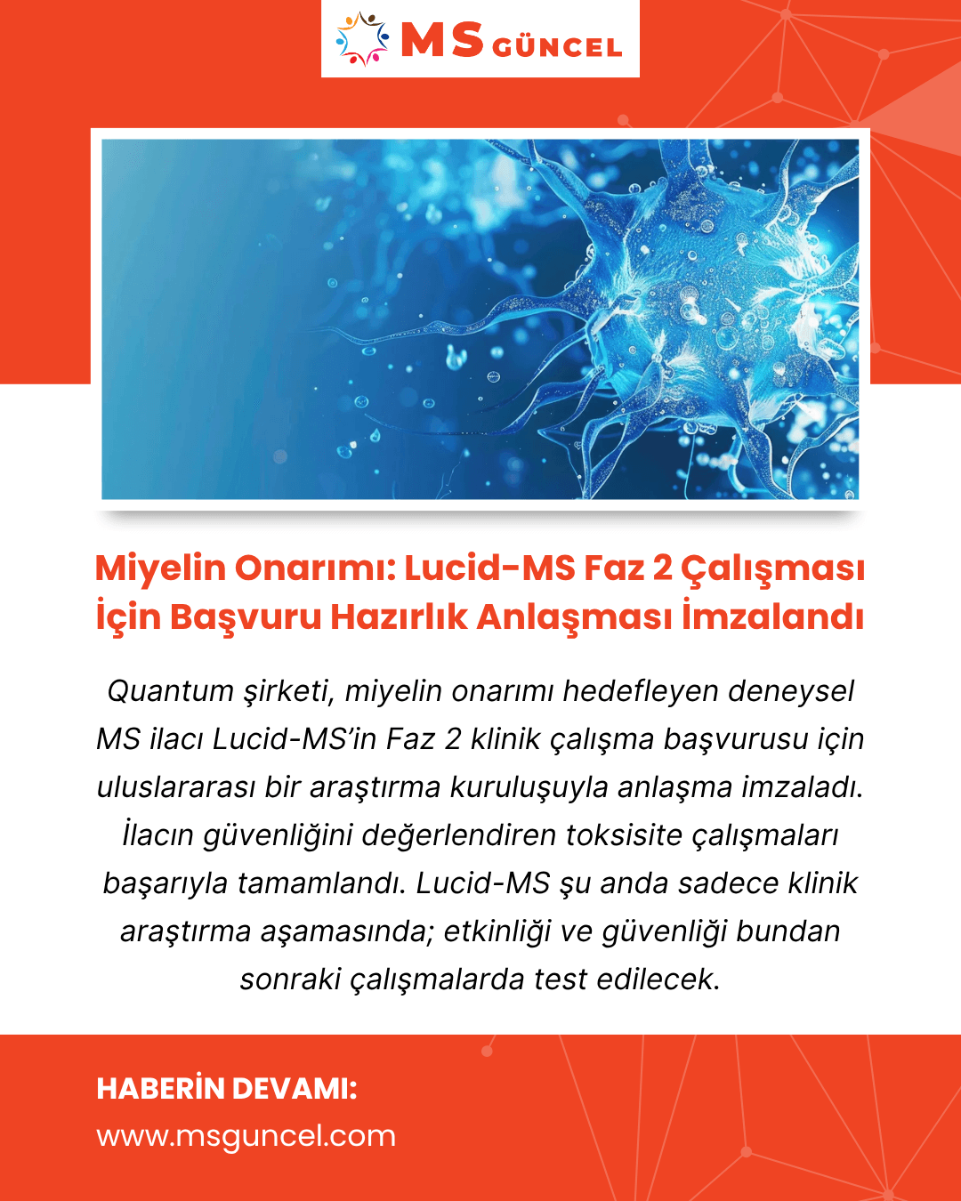 Miyelin Onarımı: Lucid-MS Faz 2 Çalışması - Hazırlık Anlaşması İmzalandı