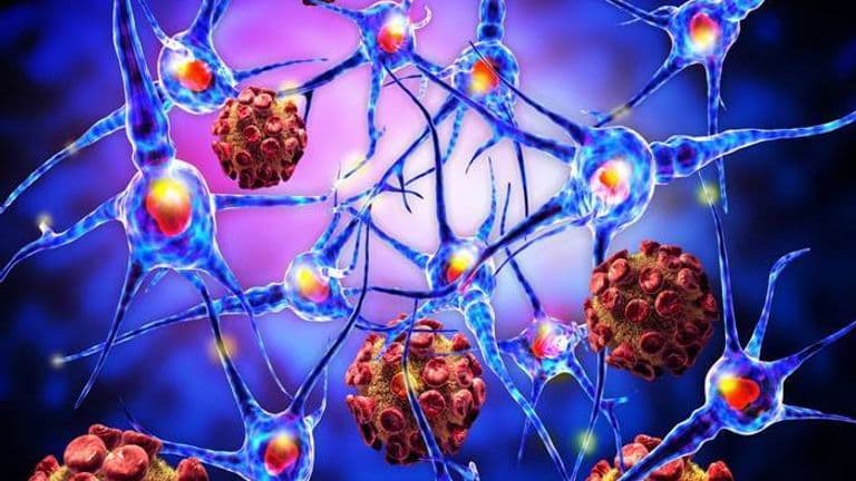 Ocrevus, PPMS ve Proinflamatuar T hücreleri