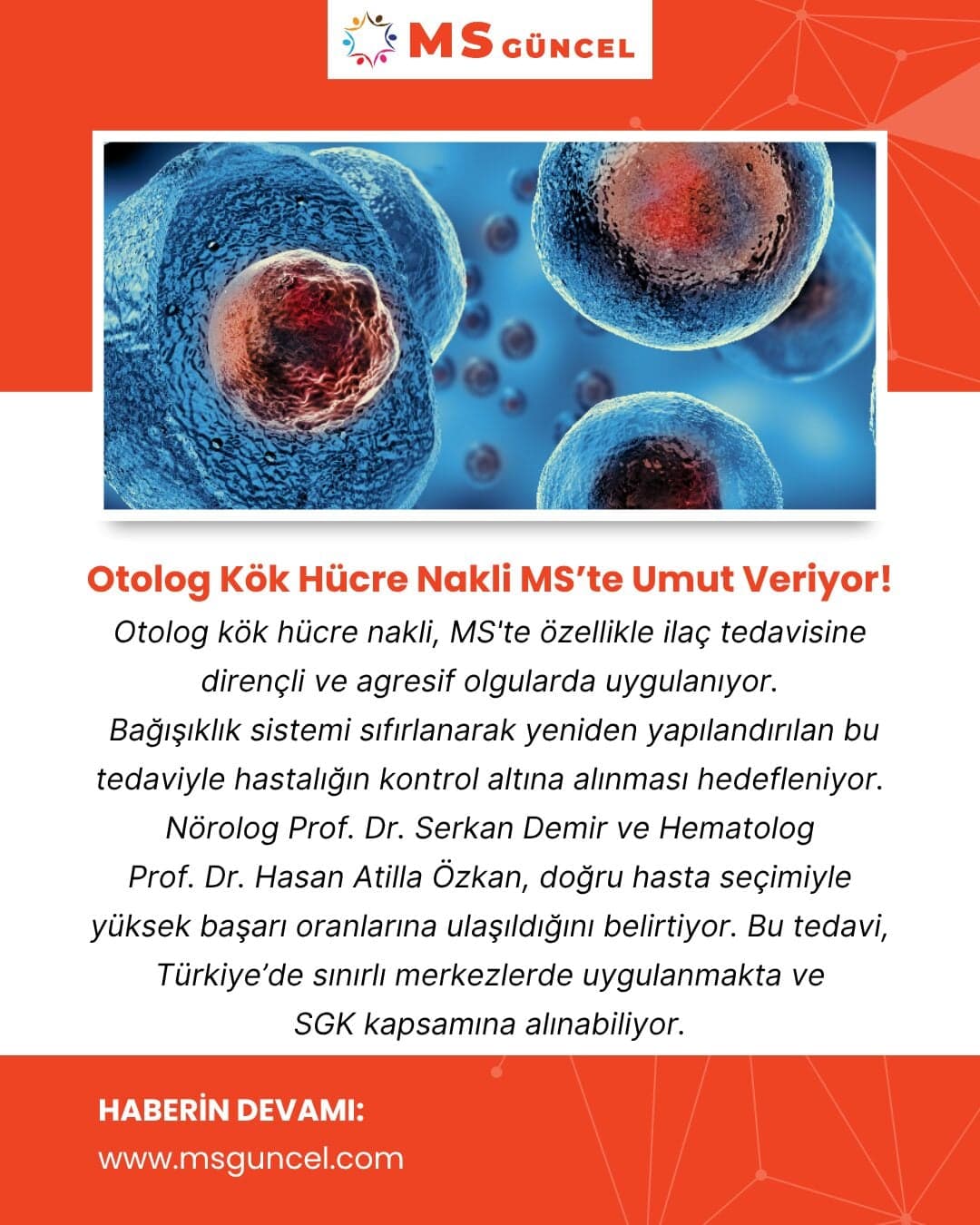 Otolog kök hücre nakli MS’te umut veriyor