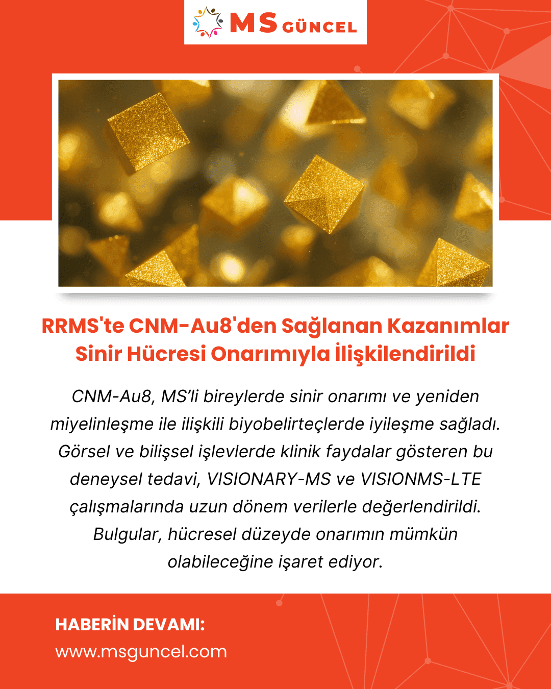 RRMS'te CNM-Au8'den Sağlanan Kazanımlar Sinir Hücresi Onarımıyla İlişkilendirildi